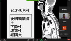 40代男性の医療情報を示すスライド、後頭腫瘍や症状についての説明が含まれています。