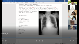 第12回診断推論セミナーの参加者が集まり、胸部X線画像を見ながら議論している様子。