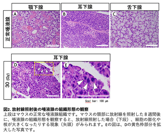 図2. 放射線照射後の唾液腺の組織形態の観察　上段はマウスの正常な唾液腺組織です。マウスの頸部に放射線を照射した8週間後に、唾液腺の組織形態を観察すると、放射線照射した場合（下段）、細部の膨化や核が大きくなったりする現象（矢頭）がみられます。Eの図は、Dの黄色枠部分を拡大した写真です。