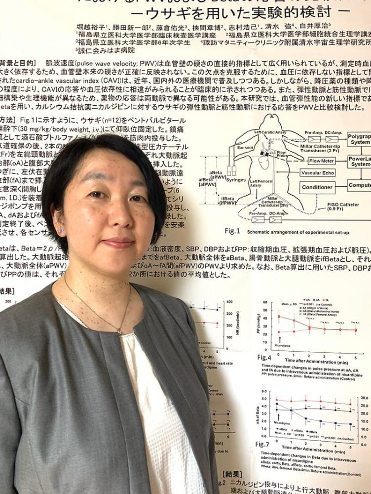 エコー検査に関するポスターの前に立つ臨床検査技師の女性。