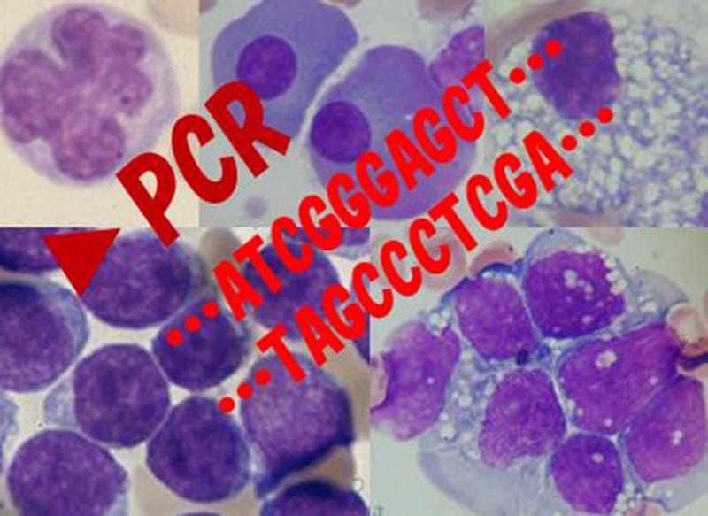 血液細胞の顕微鏡画像とPCR解析の結果を示した図。血液検査学の重要性を強調。