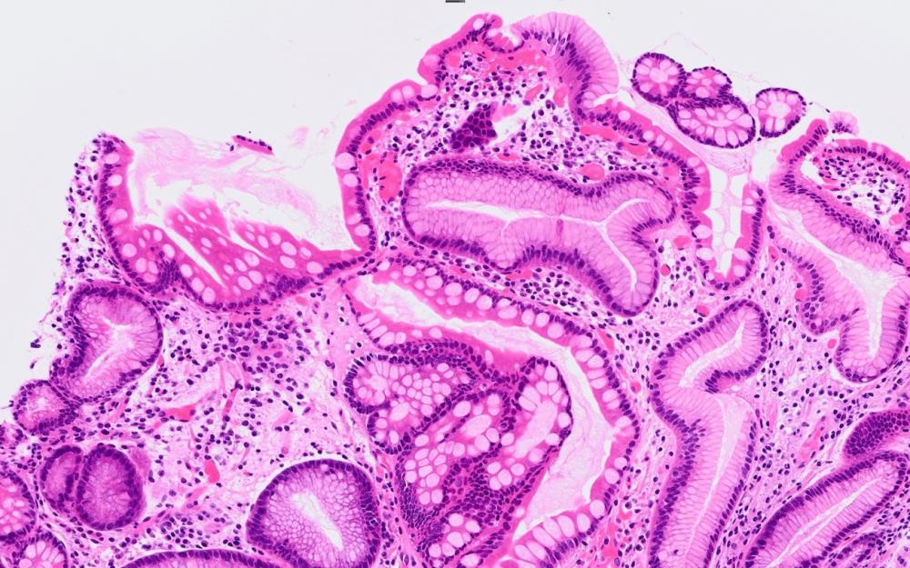 胃粘膜の病理標本の顕微鏡画像。腸上皮化生の所見が観察される。