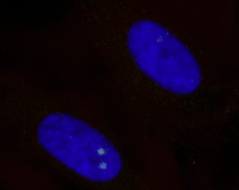 放射線によるDNA損傷を示すバイスタンダー細胞の細胞核(青色)の顕微鏡画像。