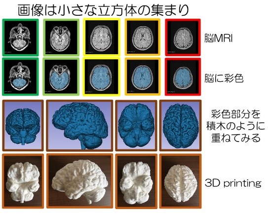 脳のMRI画像を3Dプリントした立体構造物が並ぶ様子を示す画像。上段には脳のMRI、下段には3Dプリントされた脳の模型が配置されている。