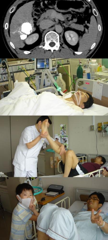 治療中のCT画像とICU、リハビリ中の患者、看護師とのやり取りを示す医療現場の様子。