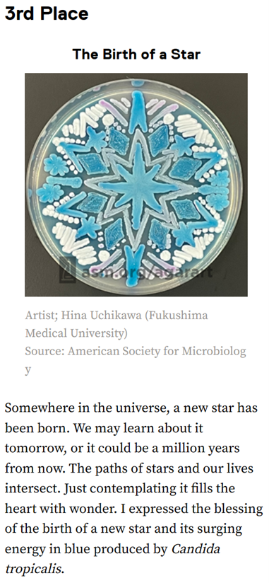 臨床検査学科の学生が制作した青い星型の微生物のアート作品が、国際コンテストで3位に入賞した。