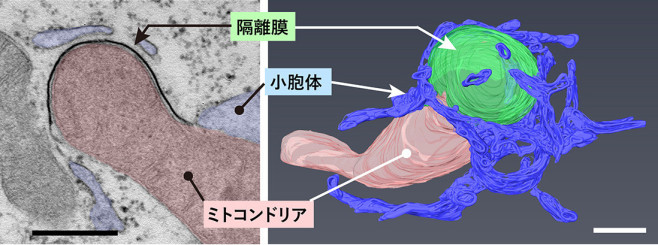 オートファジーに関連する細胞内の膜構造体やオルガネラの顕微鏡画像。