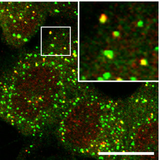浸透圧ストレスによるp62 body形成