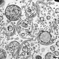 オートファジーに関連する細胞内の膜構造体やオルガネラの顕微鏡画像。
