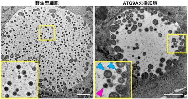 ATG9欠損細胞におけるクラミジア粒子