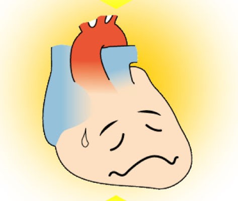 心臓のイラストで、悲しそうな表情を浮かべ、汗をかいている様子。心不全を象徴するデザイン。