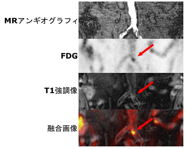 心臓の短軸像、水平長軸像、垂直長軸像のSPECT画像が横に並べて表示されています。暖色系の色で心筋の様子を示しています。