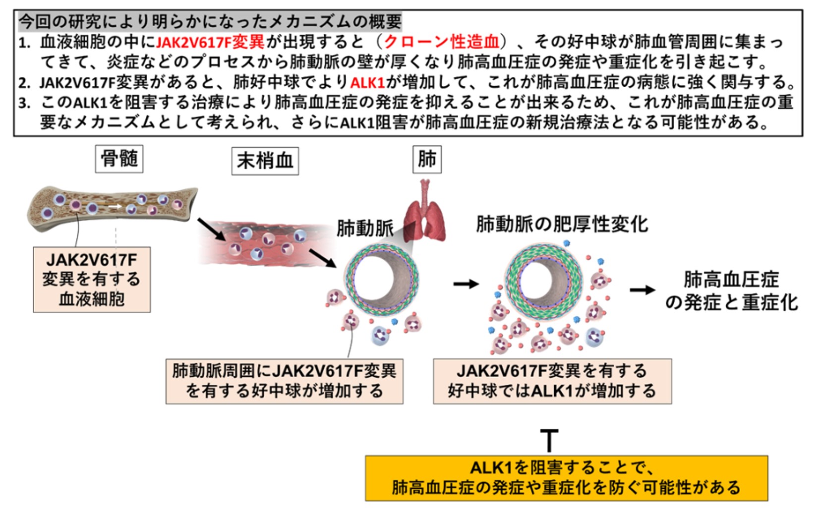 JAK2V617F変異が血液細胞内で発現すると、肺動脈の壁が厚くなり、肺高血圧症の発症・重症化に繋がる過程を示す図。ALK1阻害の可能性も説明。
