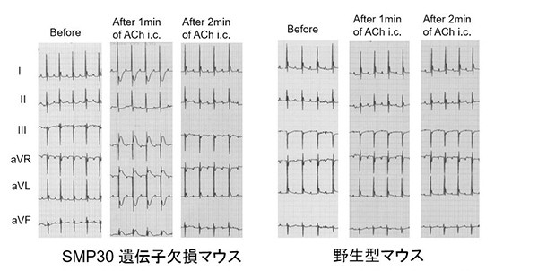 SMP30遺伝子欠損マウスと野生型マウスの心電図を示すグラフ。ACh投与前後の変化が時間ごとに比較されている。