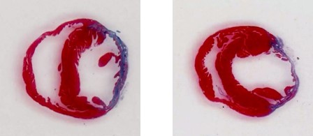 赤と青の色で染められた組織切片の画像が2つ並んでいます。それぞれの切片は円形で、内部の構造がくっきりと見えます。