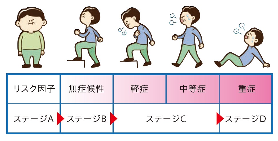 Stageごとの運動機能のイラスト