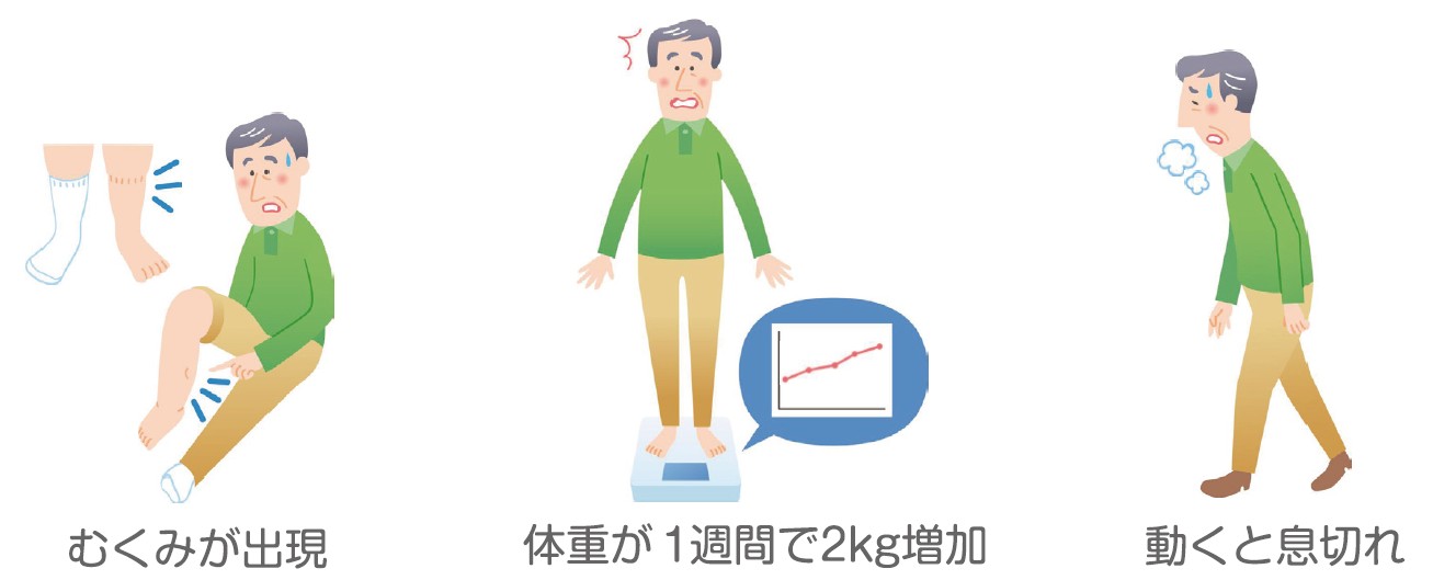 男性が足のむくみ、体重増加、息切れを感じているイラスト