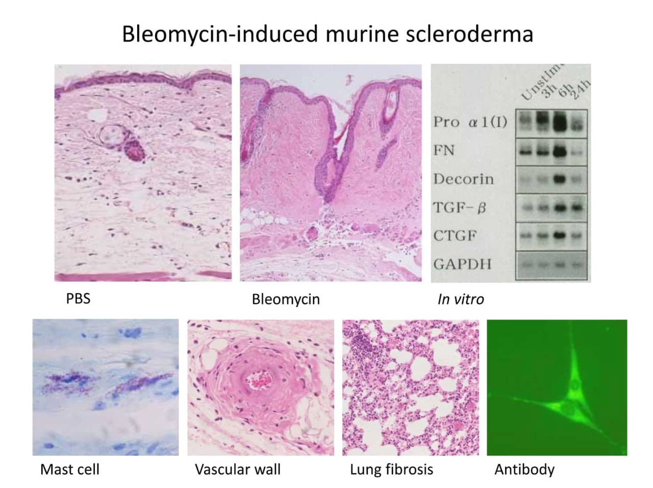 強皮症モデルマウスに関する顕微鏡画像で、線維化や細胞の変化を示す組織切片が並んでいる。