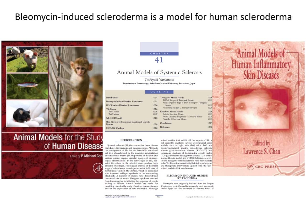 強皮症の研究に関する書籍や論文の表紙が並んでいる画像。