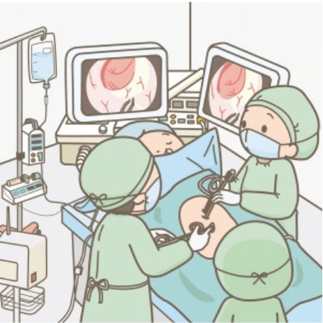 腹腔鏡下手術を受ける患者と、手術を行う医療スタッフの様子を描いたイラスト。