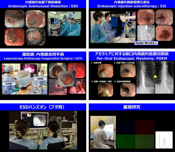 内視鏡検査や治療に関するトレーニング風景、上部消化管病変の治療法を示す画像。