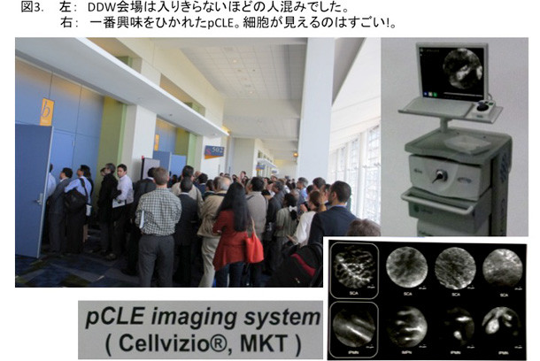 DDW会場の混雑した様子と、pCLEイメージングシステムの機器が写っている画像。