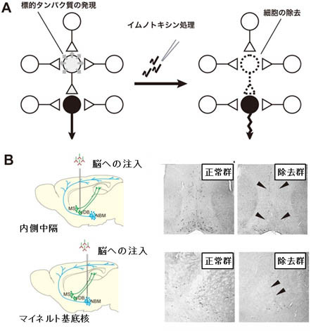 アセチルコリン神経細胞を選択的に取り除く方法を示した図