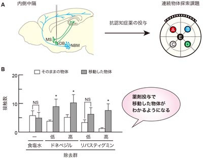 抗認知症薬投与後の状態を示す図。