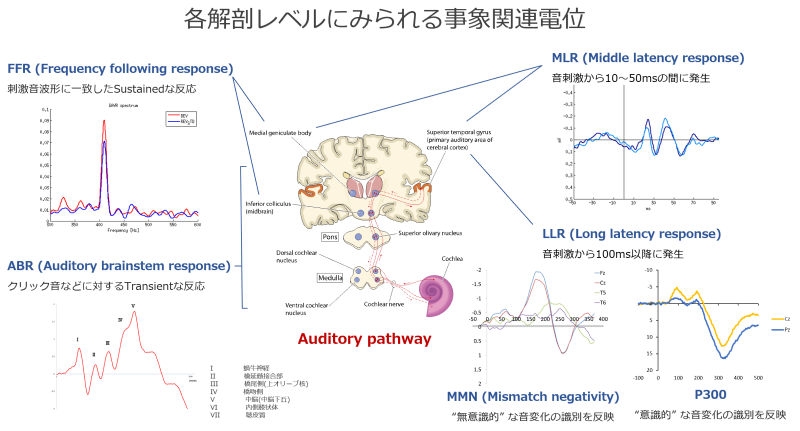 聴覚経路に関連する脳波のグラフと解剖図、各反応の説明が示された図。