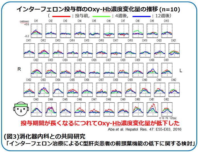 インターフェロン投与によるoxy-Hb濃度変化の推移を示すグラフ。研究データを基にした結果。