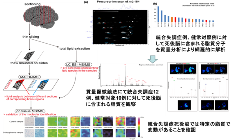 死後脳研究に関する図で、脂質代謝解析の手法や結果が示されています。