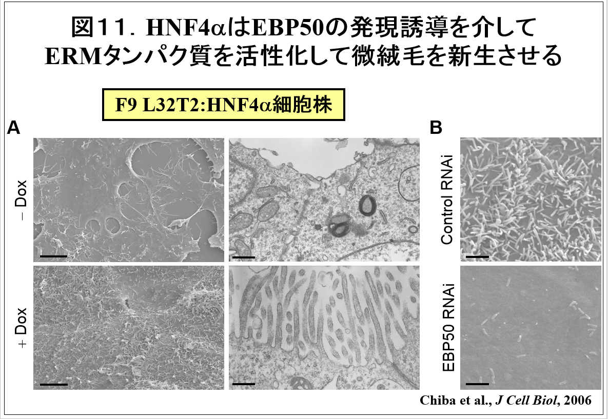 HNF4αとEBP50の関係を示す顕微鏡画像、細胞の変化を比較した実験結果。