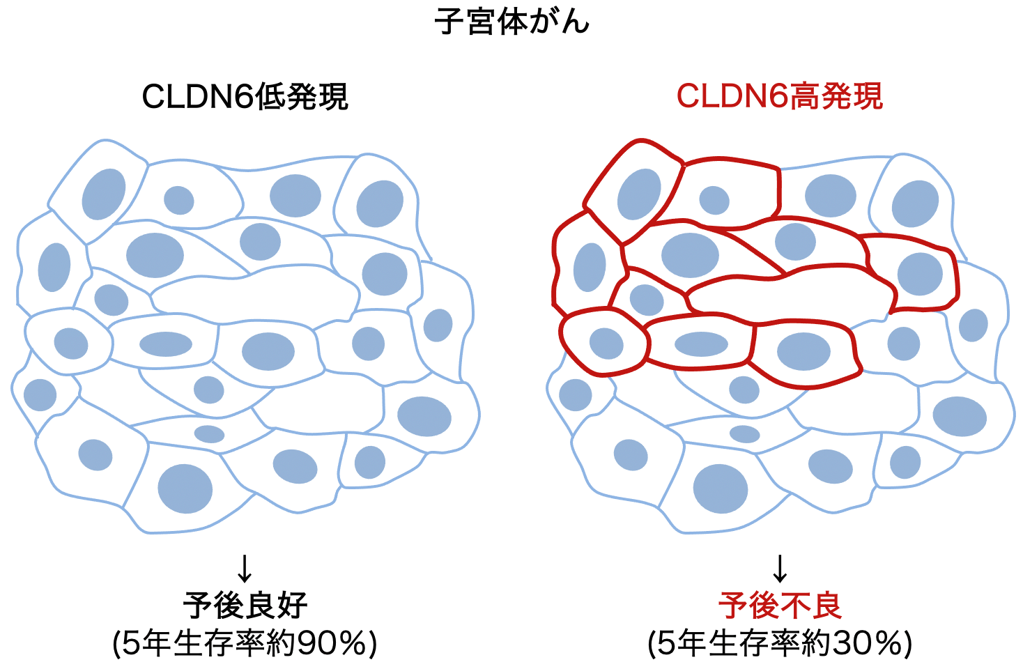 子宮体がんにおけるCLDN6の発現レベルを示す図。左は低発現、右は高発現で予後の違いを説明。