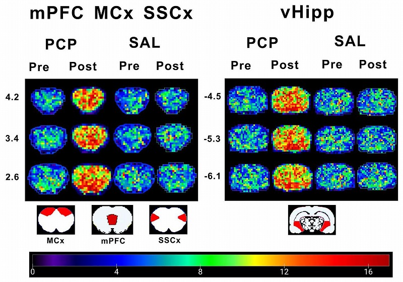 mPFC、MCx、SSCx、vHippの脳画像を示し、PCPとSALの前後比較を行ったデータ。