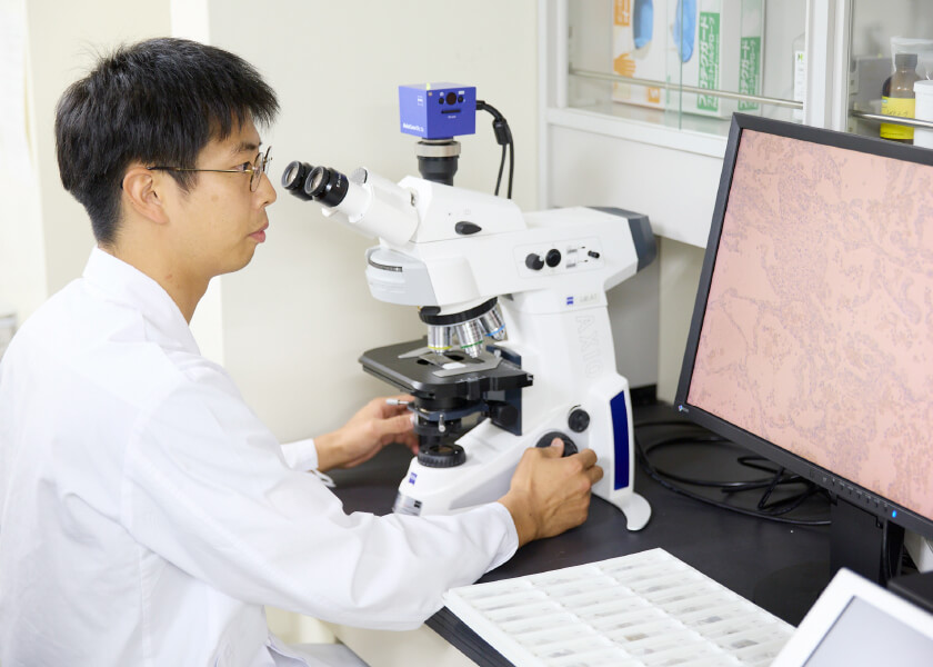 医学生が顕微鏡を使ってサンプルを観察している様子。研究室のデスクで、モニターに映る画像を確認中。