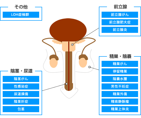 男性生殖器の図で、前立腺、精巣、陰茎などの部位別に関連する疾患を紹介している。