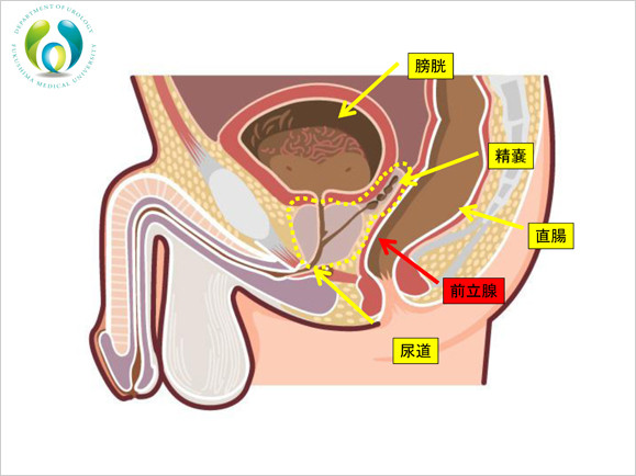 男性の骨盤断面図。膀胱、精嚢、直腸、前立腺、尿道が示されている。