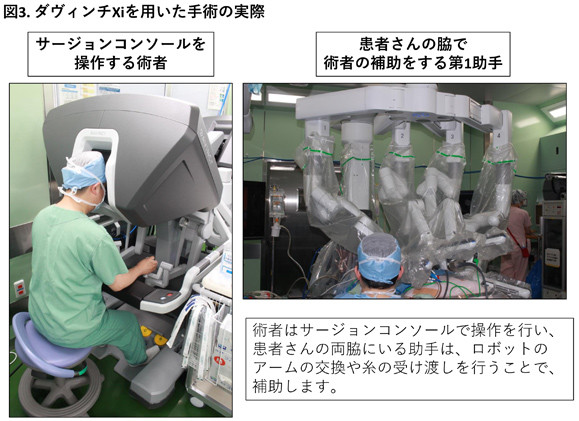手術室で医師がダヴィンチXiのサージョンコンソールを操作し、助手が患者の脇でロボットアームを補助している様子。