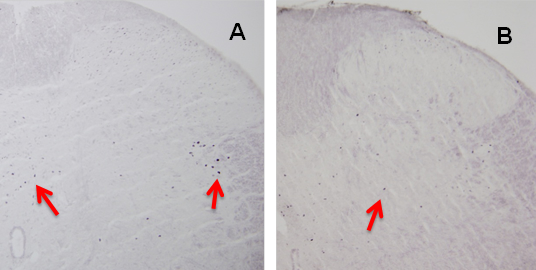 AとBにラベル付けした2枚の顕微鏡画像。