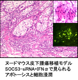 顕微鏡画像：ヌードマウス皮下の腫瘍移植モデル。SOCS3-siRNAとIFNαで見られるアポトーシスと細胞浸潤が観察される。