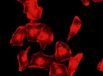 膀胱癌細胞株を活用しアクチンフィラメントを蛍光染色させた画像。