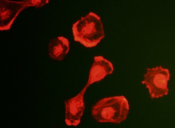 G蛋白共役型受容体を刺激してlamellipodia（膜状仮足）が形成された画像。