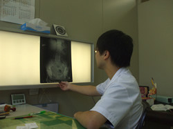 医療従事者がX線画像をライトボックスにかけて確認している様子。