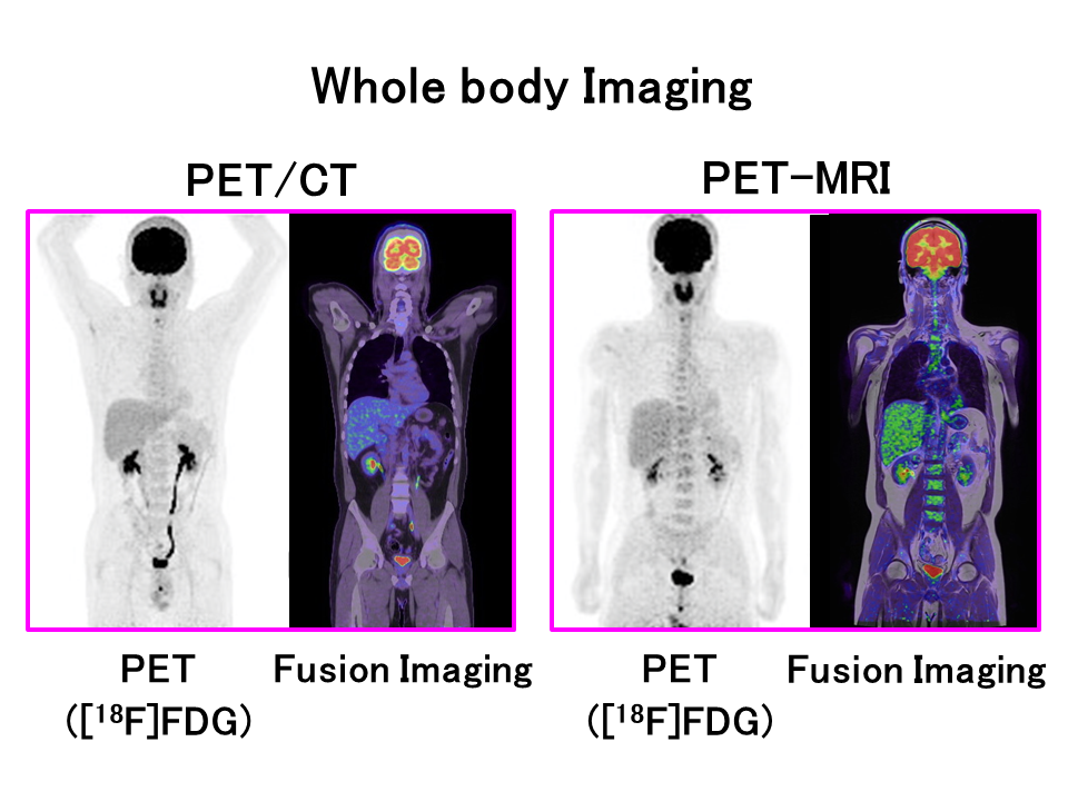 Whole body imaging comparison of PET/CT and PET-MRI scans, highlighting radiopharmaceuticals used in medical diagnostics.