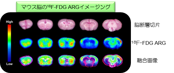 マウス脳の18F-FDG ARGイメージング結果を示す画像。高低の放射線分布が色分けされている。