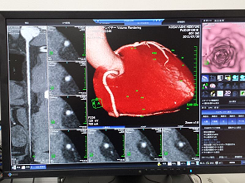 CTでスキャンした際のモニター画面。