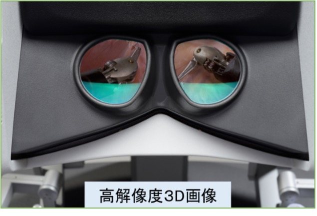VRヘッドセットのレンズを通して見える、手術中の高解像度3D映像。外科用ロボットが映し出されている。