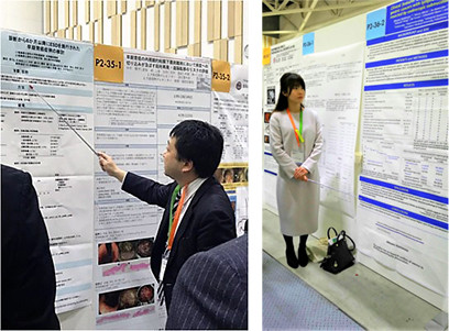 第91回日本胃癌学会総会会場のパネル前で解説する様子。
