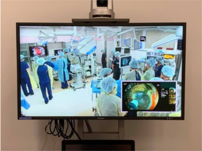 実臨床に近い環境でESDトレーニング中の様子を捉えたモニター。