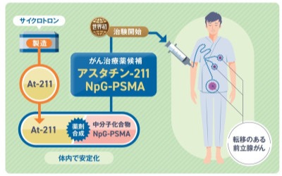 前立腺がん治療の新しい可能性 ― 放射線治療薬候補の治験